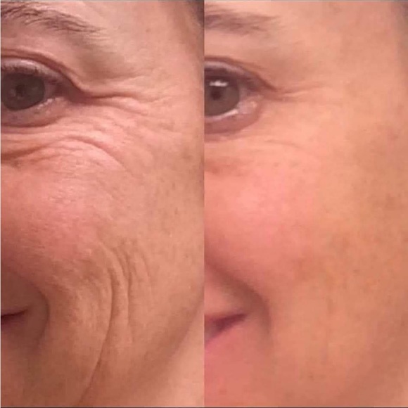 age Loc tru Face Essence Ultra - Picture 2 of 4